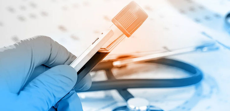 Rapid Antigen ( 15 Minutes Results)